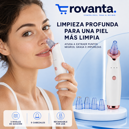 SUCCIONADOR DE PUNTOS NEGROS ROVANTA