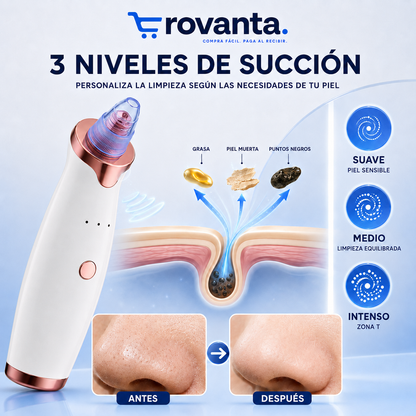 SUCCIONADOR DE PUNTOS NEGROS ROVANTA